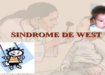 ¡Alerta! Con el Síndrome de West una rara epilepsia en niños