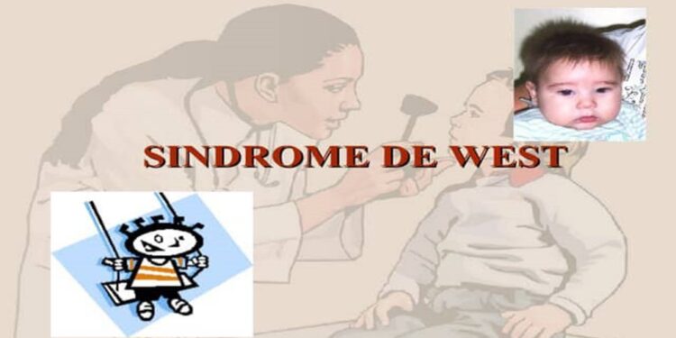 ¡Alerta! Con el Síndrome de West una rara epilepsia en niños