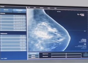 Venezuela cuenta con software para detectar cáncer de mama y tiroides