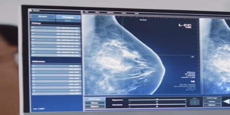 Venezuela cuenta con software para detectar cáncer de mama y tiroides