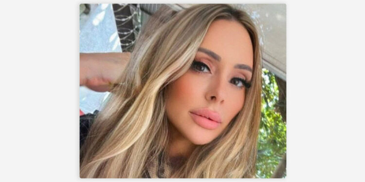 Empresaria brasileña muere tras cirugía estética facial de más de ocho horas