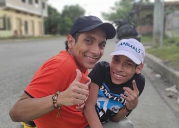 Los siameses ecuatorianos murieron en Colombia luego de una emergencia médica
