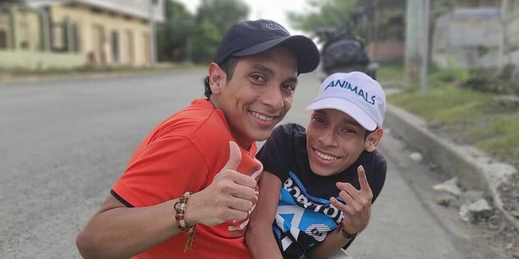Los siameses ecuatorianos murieron en Colombia luego de una emergencia médica